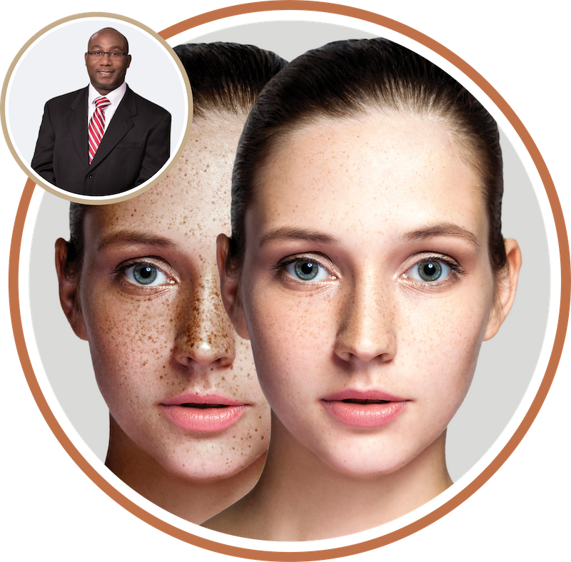 two circles with an image of a young woman before and after facial treatment in one circle; and Dr. Eko in another circle